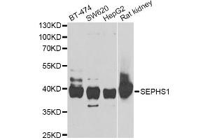 Western blot analysis of extracts of various cell lines, using SEPHS1 antibody (ABIN5973853) at 1/1000 dilution.