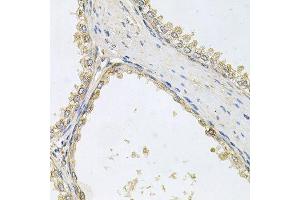 Immunohistochemistry of paraffin-embedded human prostate using POMGNT1 antibody (ABIN6003611) at dilution of 1/100 (40x lens). (POMGNT1 antibody)