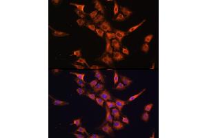 Immunofluorescence analysis of C6 cells using PFDN5 Rabbit pAb (ABIN1681328, ABIN3018415, ABIN3018416 and ABIN6220463) at dilution of 1:100 (40x lens). (PFDN5 antibody  (AA 1-154))