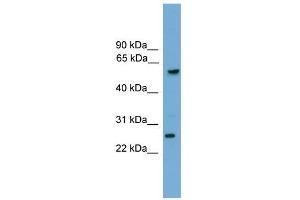 Western Blotting (WB) image for anti-Granzyme A (Granzyme 1, Cytotoxic T-Lymphocyte-Associated serine Esterase 3) (GZMA) (C-Term) antibody (ABIN928746)