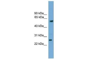 GZMA antibody used at 0. (GZMA antibody  (C-Term))