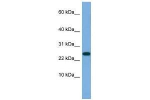 ANKRD39 antibody used at 0. (ANKRD39 antibody  (N-Term))