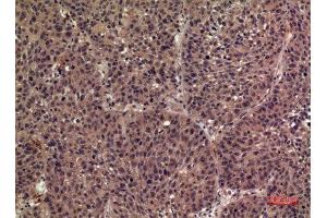 Immunohistochemistry (IHC) analysis of paraffin-embedded Human Lung, antibody was diluted at 1:100. (FIL1h antibody  (Internal Region))