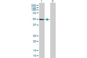 Western Blot analysis of KIAA0141 expression in transfected 293T cell line by KIAA0141 MaxPab polyclonal antibody.