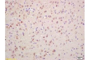 Formalin-fixed and paraffin embedded rat brain labeled with Rabbit Anti Phospho-Histone H3 (Ser10) Polyclonal Antibody, Unconjugated (ABIN742553) at 1:200 followed by conjugation to the secondary antibody and DAB staining (Histone 3 antibody  (pSer11))