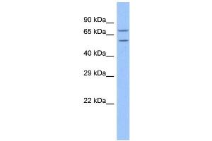 WB Suggested Anti-TRAP1 Antibody Titration: 1. (TRAP1 antibody  (N-Term))