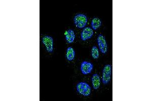 Confocal immunofluorescent analysis of ZN Antibody (Center) (ABIN653731 and ABIN2843038) with HepG2 cell followed by Alexa Fluor 488-conjugated goat anti-rabbit lgG (green). (ZNF202 antibody  (AA 342-370))