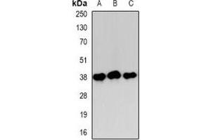 Western blot analysis of Annexin A1 expression in HEK293T (A), Hela (B), NIH3T3 (C) whole cell lysates. (Annexin a1 antibody)