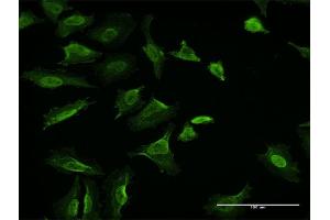 Immunofluorescence of monoclonal antibody to VCL on HeLa cell. (Vinculin antibody  (AA 1-1066))
