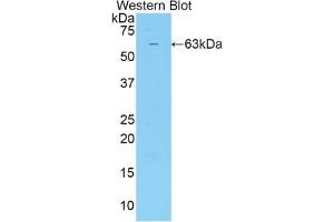 Detection of Recombinant SULF2, Human using Polyclonal Antibody to Sulfatase 2 (SULF2) (SULF2 antibody  (AA 337-649))