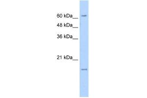 WB Suggested Anti-SLC13A3 Antibody Titration:  5. (SLC13A3 antibody  (N-Term))