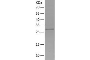 Western Blotting (WB) image for N-Acetyltransferase 1 (Arylamine N-Acetyltransferase) (NAT1) (AA 1-290) protein (His tag) (ABIN7285541) (NAT1 Protein (AA 1-290) (His tag))