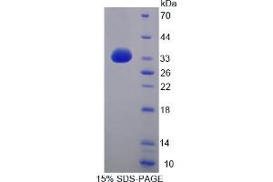Image no. 1 for Integrin beta 4 (ITGB4) (AA 1098-1356) protein (His tag) (ABIN4988717)
