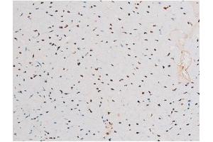 Immunohistochemistry (IHC) image for anti-Nuclear Factor-kB p65 (NFkBP65) (pThr435) antibody (ABIN6255688)