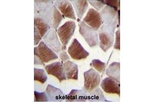 EIF2B4 Antibody (Center K161) immunohistochemistry analysis in formalin fixed and paraffin embedded human skeletal muscle followed by peroxidase conjugation of the secondary antibody and DAB staining. (EIF2B4 antibody  (Middle Region))