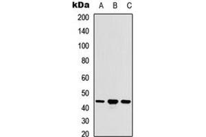 Western blot analysis of ACOT9 expression in HEK293T (A), Raw264. (ACOT9 antibody  (Center))