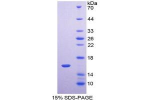 SDS-PAGE analysis of Human TMEM27 Protein.