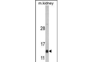 Western blot analysis of DNAJC19 Antibody (Center) (ABIN390453 and ABIN2840826) in mouse kidney tissue lysates (35 μg/lane). (DNAJC19 antibody  (AA 55-84))