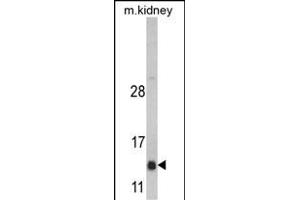 Western blot analysis of DNAJC19 Antibody (Center) (ABIN390453 and ABIN2840826) in mouse kidney tissue lysates (35 μg/lane). (DNAJC19 antibody  (AA 55-84))