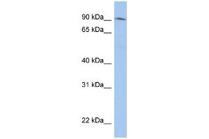WB Suggested Anti-LRRC33 Antibody Titration: 0. (LRRC33 antibody  (N-Term))