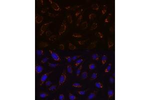Immunofluorescence analysis of U-2 OS cells using DLDH/DLD Rabbit mAb (ABIN7266766) at dilution of 1:100 (40x lens).