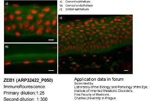 Image no. 3 for anti-Zinc Finger E-Box Binding Homeobox 1 (ZEB1) (N-Term) antibody (ABIN2779631) (ZEB1 antibody  (N-Term))