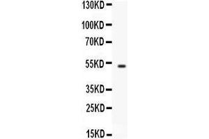 Western blot analysis of FCGRT expression in A549 whole cell lysates (lane 1). (FcRn antibody  (AA 56-291))