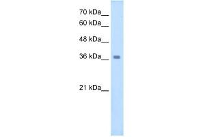 WB Suggested Anti-WNT16 Antibody Titration:  2. (WNT16 antibody  (C-Term))