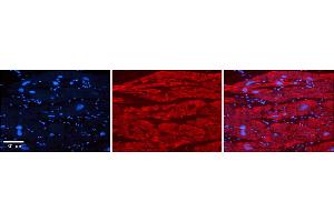 Rabbit Anti-TRIM10 Antibody    Formalin Fixed Paraffin Embedded Tissue: Human Adult heart  Observed Staining: Cytoplasmic Primary Antibody Concentration: 1:600 Secondary Antibody: Donkey anti-Rabbit-Cy2/3 Secondary Antibody Concentration: 1:200 Magnification: 20X Exposure Time: 0. (TRIM10 antibody  (Middle Region))