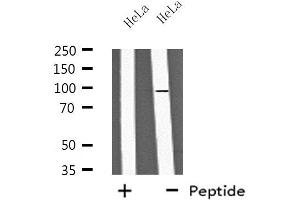 Western blot analysis of extracts from HeLa cells, using PA2G6 antibody. (PLA2G6 antibody  (Internal Region))