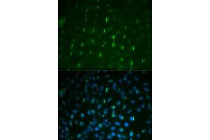 Immunofluorescence analysis of U2OS cells using Phospho-H2AFX-S139 antibody (ABIN5969940). (H2AFX antibody  (pSer139))