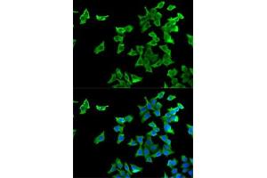 Immunofluorescence analysis of U2OS cells using HTR2B antibody (ABIN6127310, ABIN6142069, ABIN6142070 and ABIN6221320). (Serotonin Receptor 2B antibody  (AA 382-481))