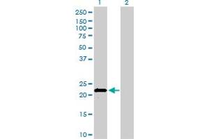 Western Blot analysis of APOM expression in transfected 293T cell line by APOM monoclonal antibody (M01), clone 1F10. (Apolipoprotein M antibody  (AA 23-188))