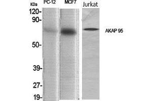 Western Blot (WB) analysis of specific cells using AKAP 95 Polyclonal Antibody. (AKAP8 antibody  (Internal Region))