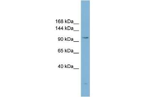WB Suggested Anti-ACLY Antibody Titration:  0. (ACLY antibody  (Middle Region))