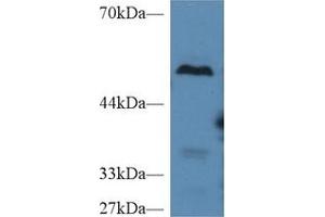 Western Blot; Sample: Mouse Liver lysate; Primary Ab: 2µg/ml Rabbit Anti-Mouse TAFI Antibody Second Ab: 0. (CPB2 antibody  (AA 113-422))