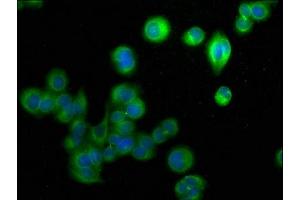 Immunofluorescence staining of PC-3 cells with ABIN7152615 at 1:50, counter-stained with DAPI. (FABP9 antibody  (AA 1-132))