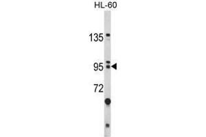 Image no. 1 for anti-Bicaudal C Homolog 1 (BICC1) (N-Term) antibody (ABIN452782) (BICC1 antibody  (N-Term))