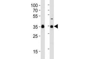 Western blot analysis of lysate from human NCCIT, mouse F9 cell line (left to right) using anti-SOX2 antibody at 1:1000 for each lane.