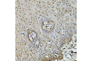 Immunohistochemistry of paraffin-embedded human esophagus using CPOX antibody. (CPOX antibody  (AA 111-454))