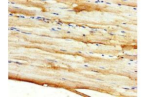 IHC image of ABIN7149882 diluted at 1:500 and staining in paraffin-embedded human skeletal muscle tissue performed on a Leica BondTM system.