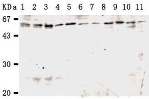Western Blotting (WB) image for anti-Karyopherin alpha 3 (Importin alpha 4) (KPNA3) antibody (ABIN1449200) (KPNA3 antibody)