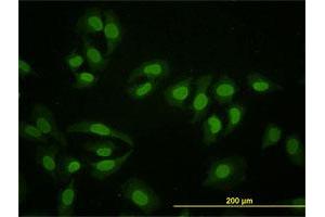 Immunofluorescence of monoclonal antibody to HNF4A on HeLa cell. (HNF4A antibody  (AA 324-423))