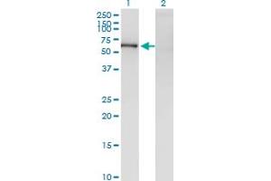 Western Blot analysis of ZNF192 expression in transfected 293T cell line by ZNF192 monoclonal antibody (M01), clone 1F2.