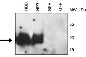 Binding of CR3022 to RBD and NP3 (fragment 3) of 2019nCoV proteins by Western blotting . (SARS-CoV-2 antibody)