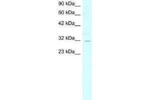 Human HepG2; WB Suggested Anti-ASGR2 Antibody Titration: 4.