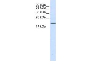 Western Blotting (WB) image for anti-Sodium Channel, Voltage-Gated, Type III, beta Subunit (SCN3B) antibody (ABIN2461577)