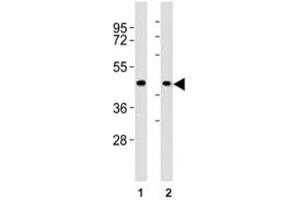 Western blot testing of CCR1 antibody at 1:2000 dilution. (CCR1 antibody  (AA 13-44))