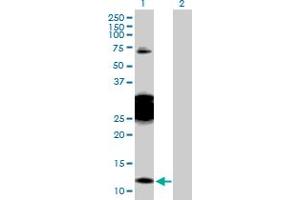 Western Blot analysis of CBY1 expression in transfected 293T cell line by CBY1 MaxPab polyclonal antibody. (CBY1/PGEA1 antibody  (AA 1-126))