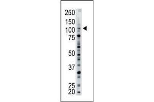 The anti-USP15 Pab (ABIN388904 and ABIN2839189) is used in Western blot to detect USP15 in mouse brain tissue lysate. (USP15 antibody  (N-Term))